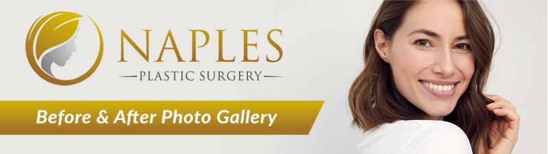 Visit the Naples Plastic Surgery before and after Gallery